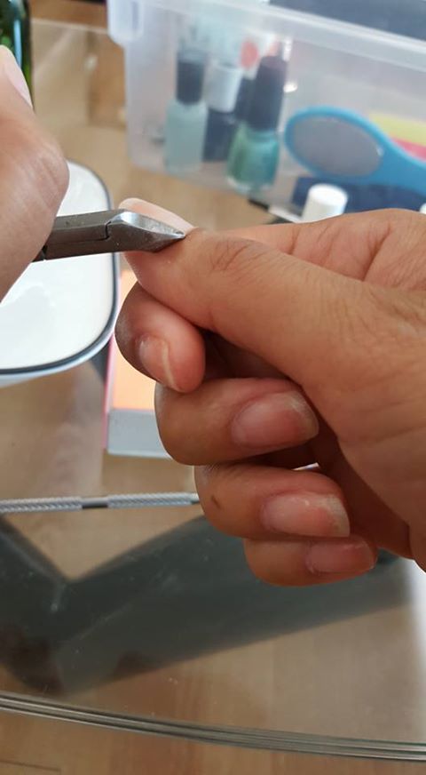 cut cuticles, Easy DIY